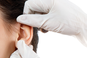 Cosmetic Ear Surgery