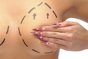 World class Breast Lift surgery for USA, UK and UAE patients